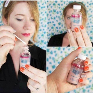 kem thuốc chấm mụn bye bye blemish