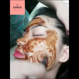 Hồng Sâm cấy căng bóng da baby Hàn Quốc