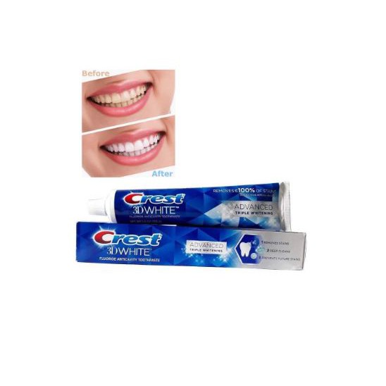 Kem đánh răng CREST 3D White Advanced Triple Whitening 158g của Mỹ