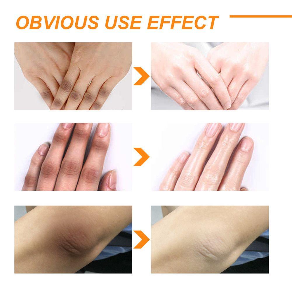 Gel Tẩy Tế Bào Chết Dưỡng Ẩm Làm Trắng Da Toàn Thân