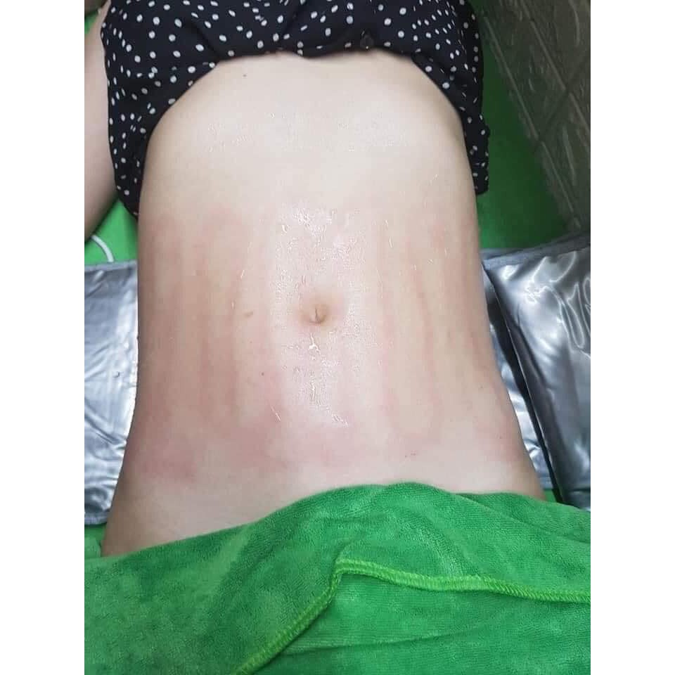 Đai Nóng Rung Massage, Đai Nóng Rung Giảm Béo