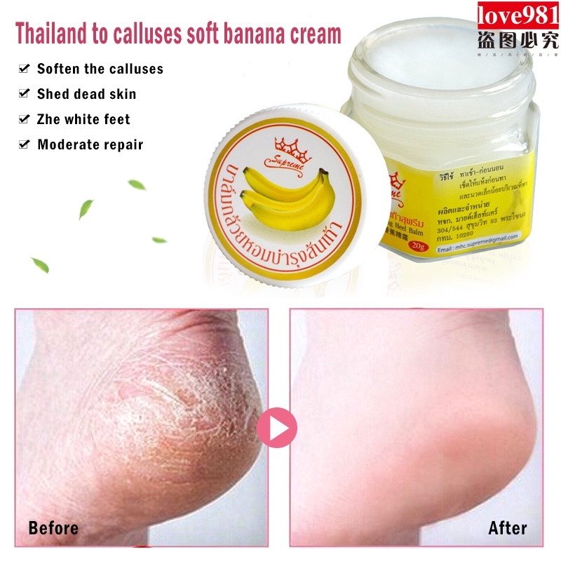 Kem dưỡng ẩm chống nứt nẻ tinh dầu chuối cao cấp | BigBuy360 - bigbuy360.vn