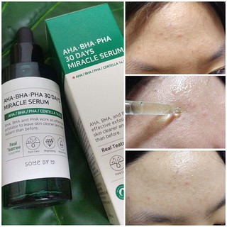 Serum Some By Mi AHA-BHA-PHA 30 Days Miracle