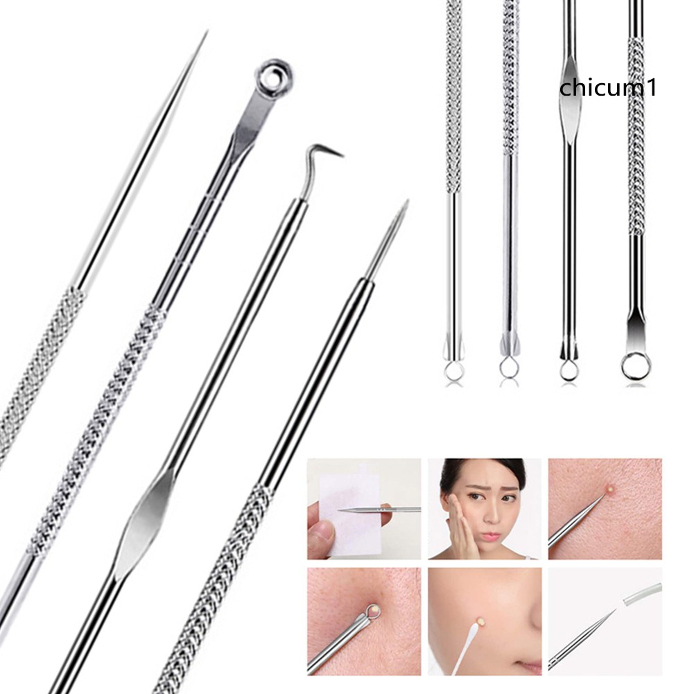 [Hàng mới về] Bộ 4 Kim Nặn Mụn Đầu Đen Dễ Dùng Tiện Lợi Thân Thiện Với Làn Da