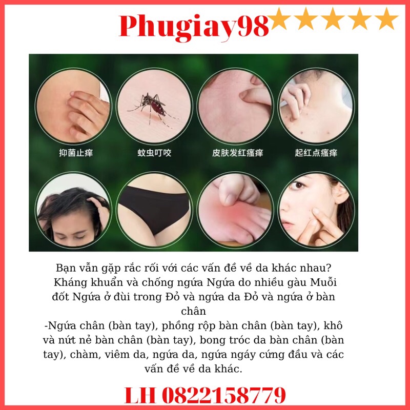 Kem bôi hỗ trợ các vấn đề nấm và ngứa da rất hiệu quả hàng nội địa Trung Quốc ( hàng Có sẵn)