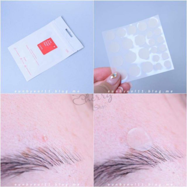 Dán mụn COSRX Acne Pimple Master Patch | BigBuy360 - bigbuy360.vn