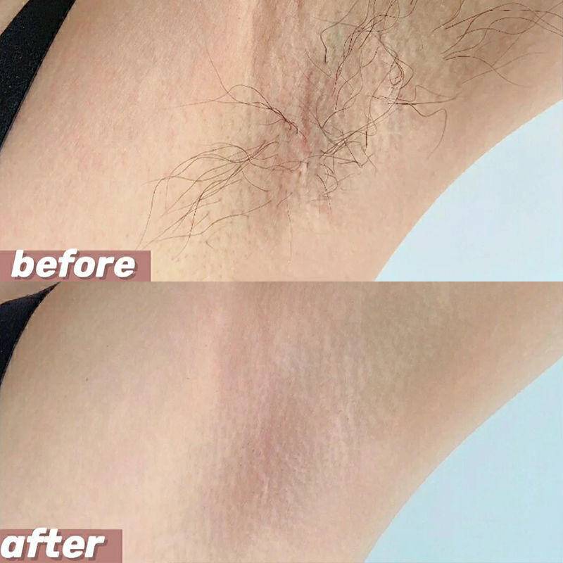 Kem Tẩy Lông Không Gây Đau Chăm Sóc Da Vùng Dưới Cánh Tay/Chân/Toàn Thân