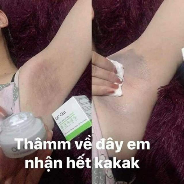 Ol Cell kem hút thâm nách, thâm body hàn quốc | BigBuy360 - bigbuy360.vn