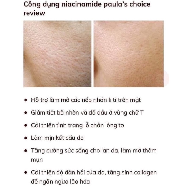 Mini 2ml - Serum dưỡng trắng, thu nhỏ lỗ chân lông Paula Choice Niacinamide 20% Treatment
