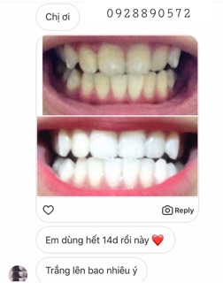 MIẾNG DÁN TRẮNG RĂNG CREST 3D WHITE ✨ LOẠI Professional
