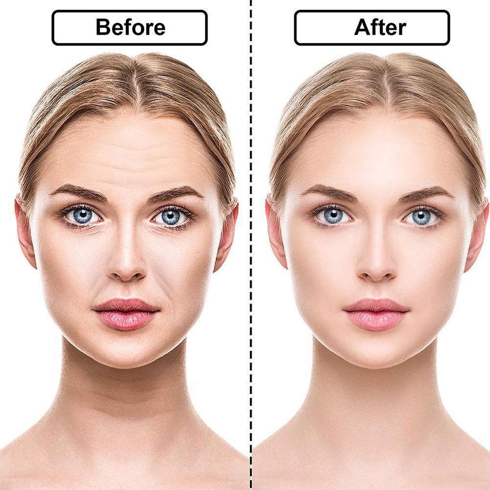 Miếng Dán Nâng Cơ Mặt / Mắt / Trán Chống Lão Hóa / Nếp Nhăn Cho Nam