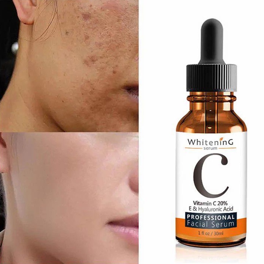 Tinh Chất Vitamin C 30ml Chống Lão Hóa Dưỡng Ẩm Làm Trắng Sáng Da Kiềm Dầu Chống Oxy Hóa Se Khít Lỗ Chân Lông
