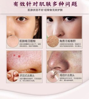 Hàng order❗️Gel đẩy mụn ẩn