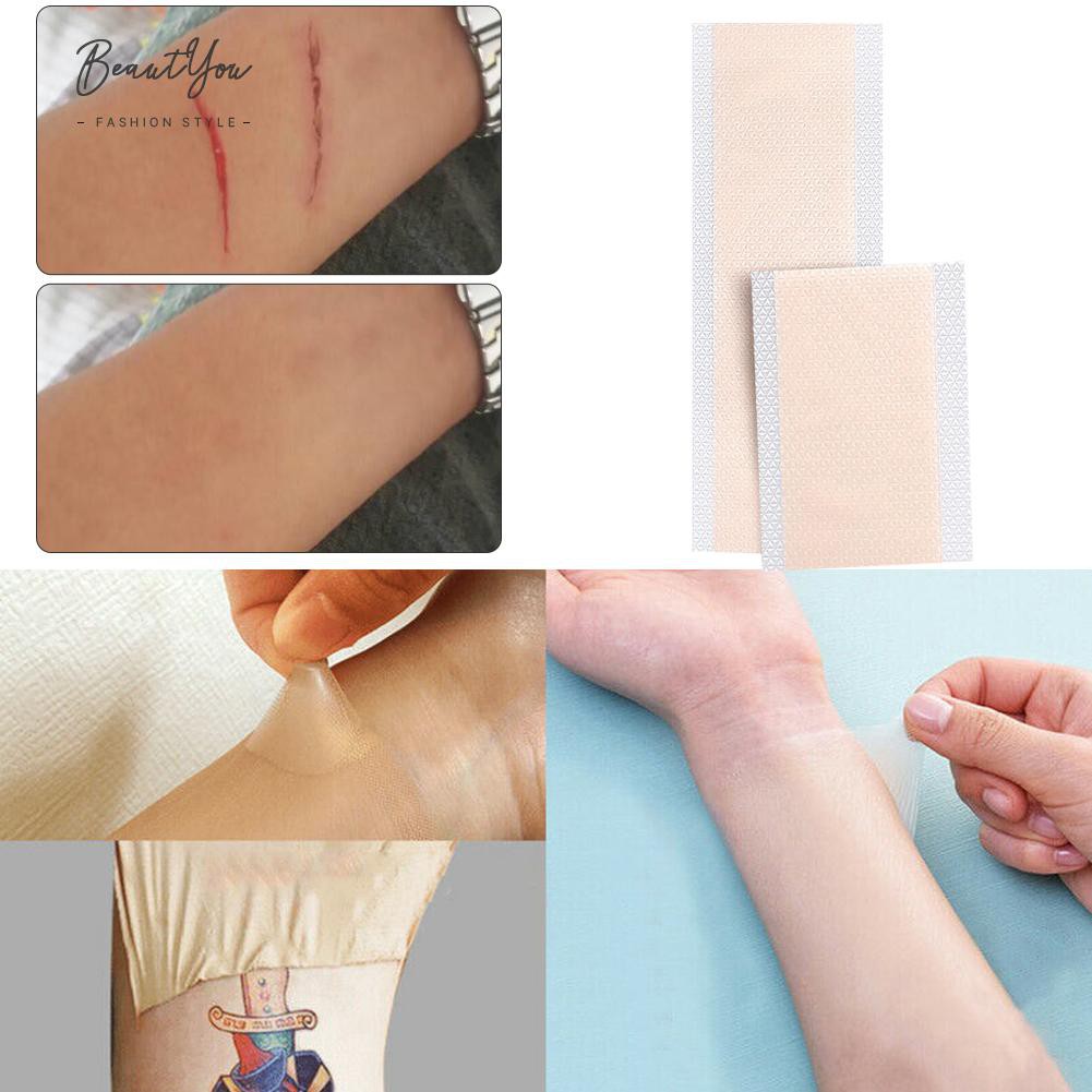 (Hàng Mới Về) Miếng Dán Che Khuyết Điểm Sẹo Mụn Vô Hình Bằng Silicone | BigBuy360 - bigbuy360.vn