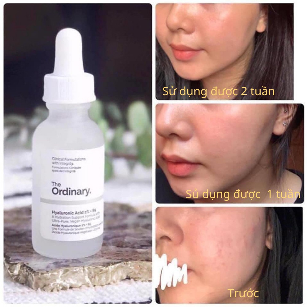 [Bản Canada]The Ordinary Hyaluronic Acid 2% + B5 Tinh chất dưỡng ẩm phục hồi | BigBuy360 - bigbuy360.vn