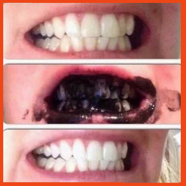 Bột Trắng Răng Than Hoạt Tính Bright Smile