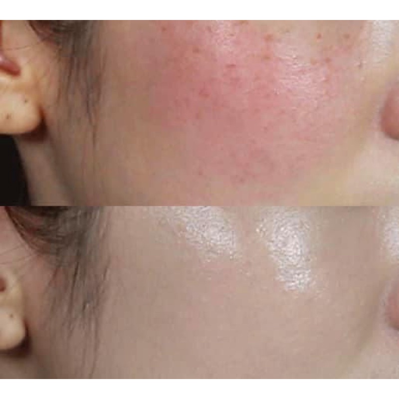 Serum Tinh Chất Vàng Pure Gold Ampoule 100ml