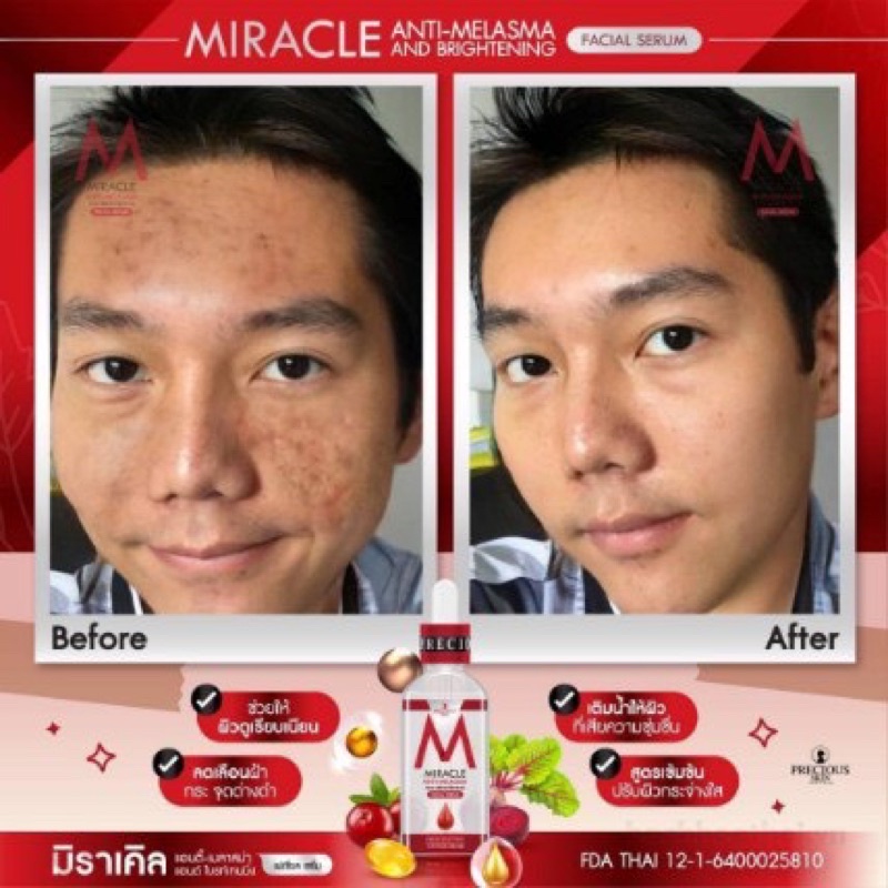 Miracle Anti-Melasma and Brightening Facial Serum giảm ņám dưỡng trắŉg da Thái Lan 50ml