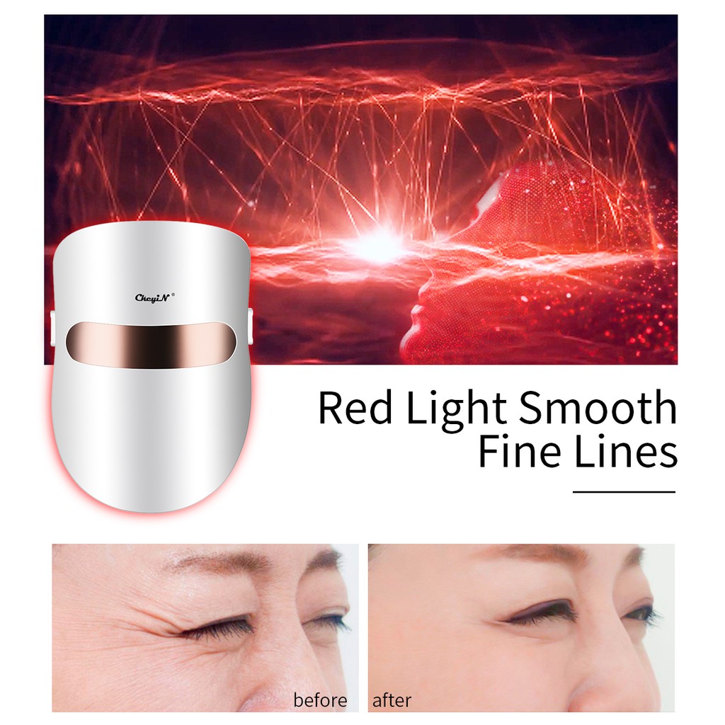 Mặt nạ Photon CkeyiN giúp trẻ hóa làn da làm đẹp da mặt hiệu quả