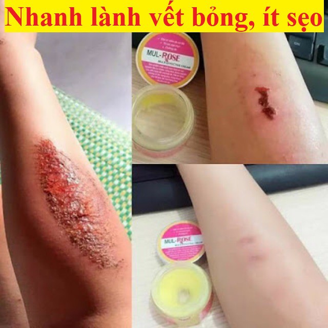 Kem MUL ROSE chính hãng, kem nghệ MUL ROSE dưỡng da dưỡng ẩm 30g