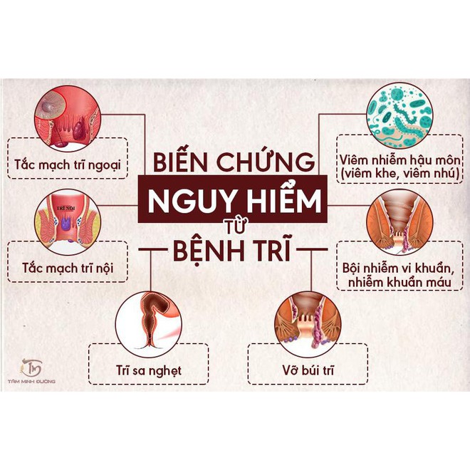 An Trĩ Vương - Dành cho người bị trĩ, táo bón, nóng trong người