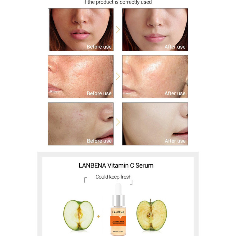 Serum tinh chất vitamin C làm trắng giữ ẩm chăm sóc làn da 15ml LANBENA