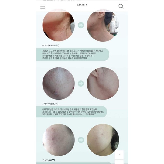 Set dưỡng serum+lotion DR&CO cho da mụn