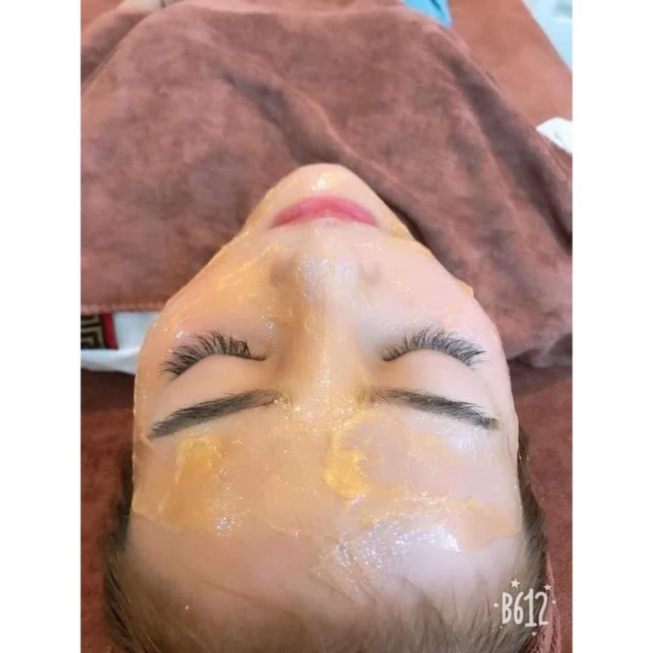 Cấy trắng collagen trắng mịn da