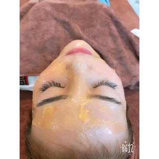 Cấy trắng collagen trắng mịn da, cấy trắng vàng nano, huyết hoa hồng, mầm cám gạo