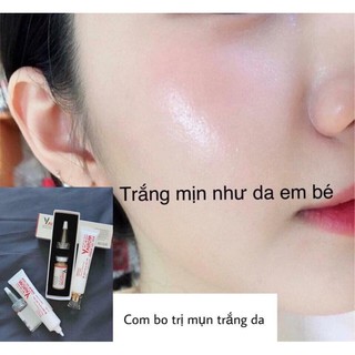 (Combo 3 lọ) Serum biểu bì thực vật V-AURORA