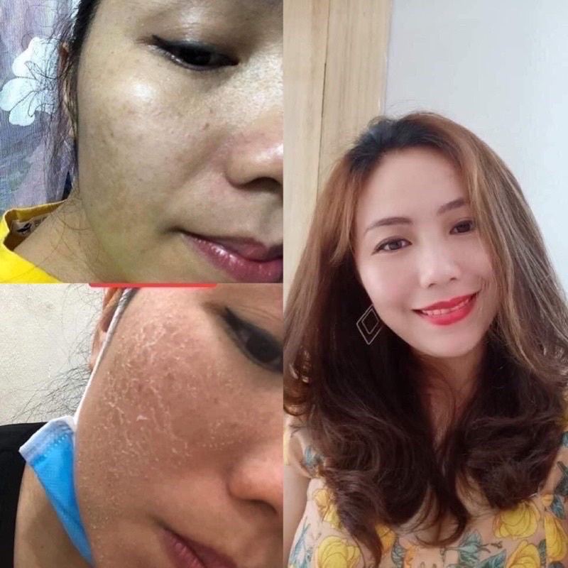 SERUM TÁI TẠO DA NHÂN SÂM TRẦN KIM HUYỀN