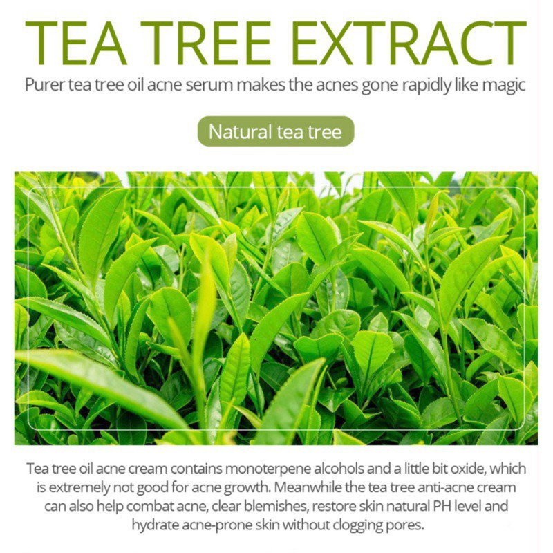 [Hàng mới về] Tinh dầu tràm trà hỗ trợ giảm sẹo mụn dưỡng ẩm kiềm dầu cho da | BigBuy360 - bigbuy360.vn