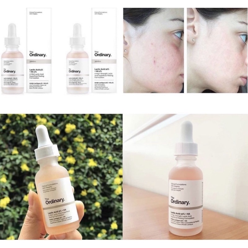 Serum AHA tẩy da chết, mờ thâm The Ordinary Lactic Acid 5%, 10% + HA 2% 30ml