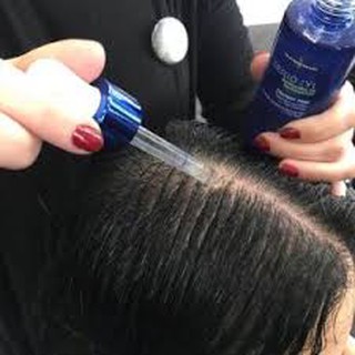 Tinh chất kích thích mọc tóc Loreal Serioxyl Denser Hair 90ml
