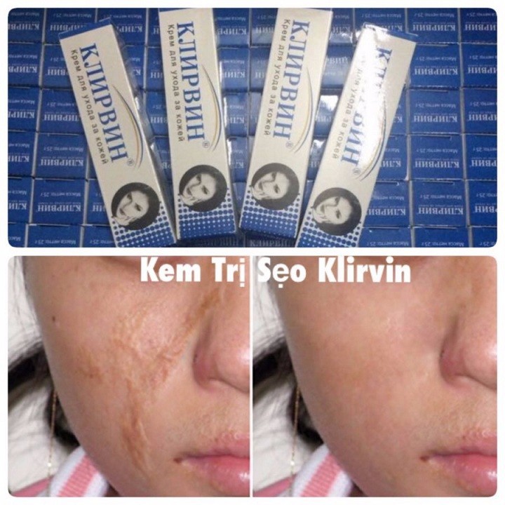 Kem mờ sẹo Nga Klirvin 25g - mỹ phẩm MINH HÀ cosmetics