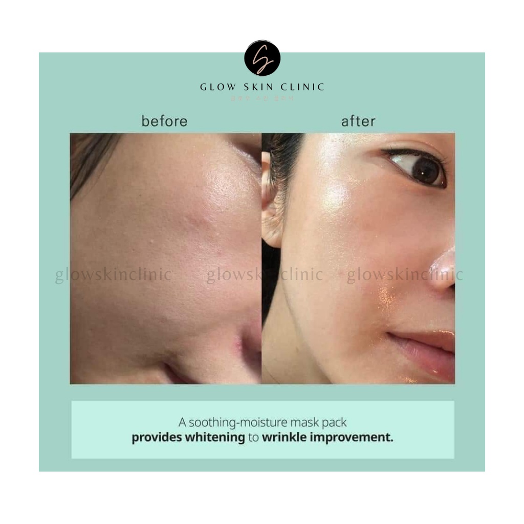 Mặt nạ Derma J Pestastin cấp ẩm, phục hồi, làm sáng da
