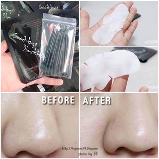 Miếng Đẩy Mụn Đầu Đen Ciracle Good-bye Blackhead