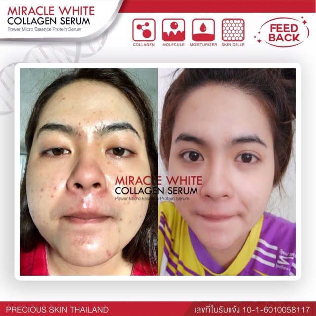 SERUM DƯỠNG DA VÀ GIẢM THÂM NÁM MIRACLE WHITE COLLAGEN 10ml