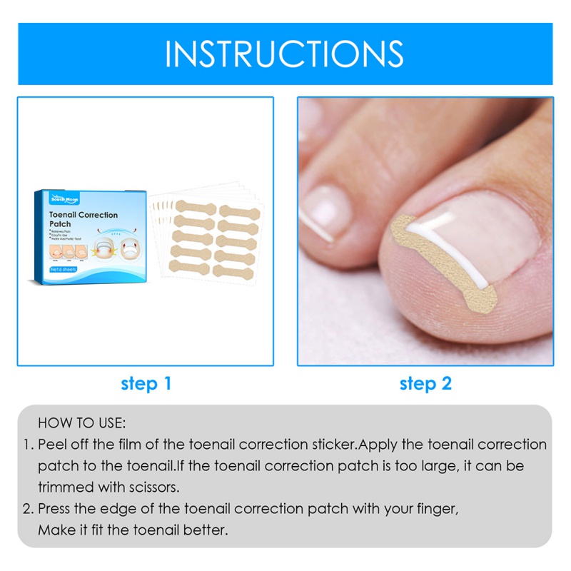 Bộ 6 Miếng Dán Chỉnh Sửa Móng Chân Giảm Đau Không Thấm Nước