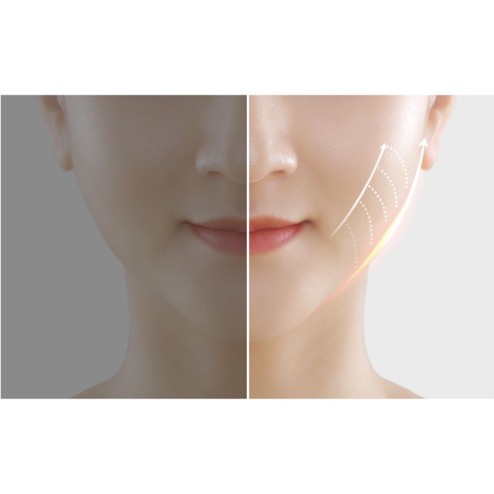 Máy nâng cơ mặt H1031 định hình vilne , mát xa mặt xóa nọng cằm công nghệ hàn quốc giúp trẻ hóa da chuẩn spa