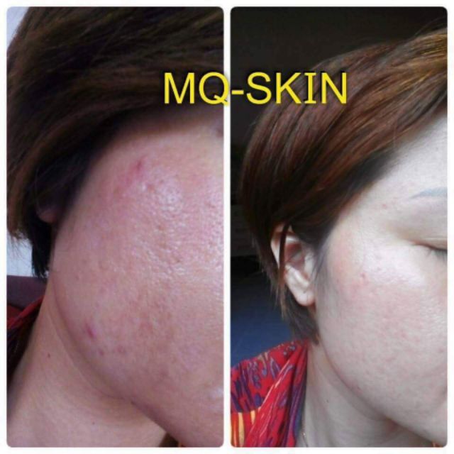 [CHÍNH HÃNG]Thay da sinh học nhân sâm Hàn Quốc | BigBuy360 - bigbuy360.vn