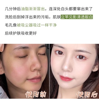 Mặt nạ đất sét