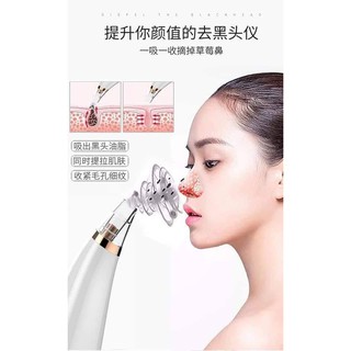 Máy hút mụn đầu đen mini cầm tay