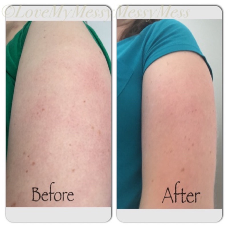 [AUTH-ĐỦ BILL] KEM DƯỠNG DA GOLD BOND ULTIMATE ROUGH & BUMPY SKIN | BigBuy360 - bigbuy360.vn