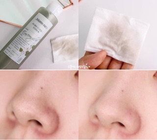TONER DIẾP CÁ MAMONDE