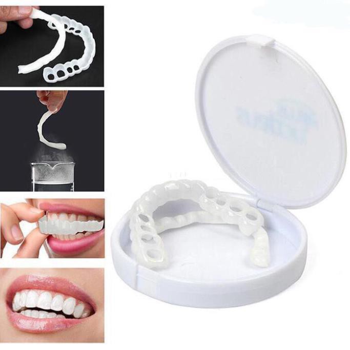 Dụng cụ niềng răng tại nhà snapon smile