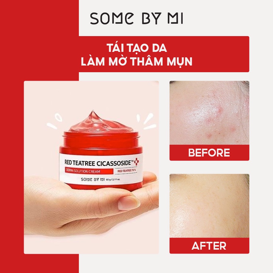 Kem Dưỡng Giảm Mụn Cho Da Nhạy Cảm Some By Mi Teatree Cicassoside Final Solution Cream 60g