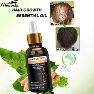 Serum kích thích mọc tóc chống rối tiện dụng