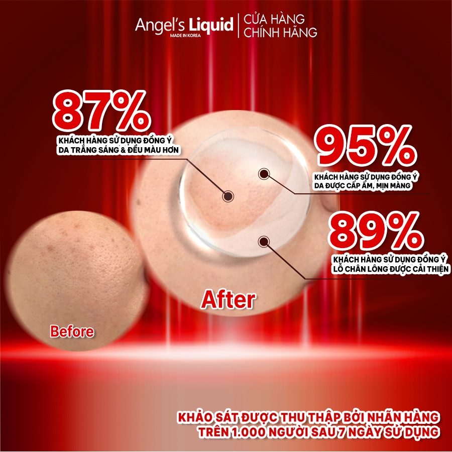 Bộ Sản Phẩm Serum, Kem Dưỡng Trắng Se Khít Lỗ Chân Lông Angel's Liquid Glutathione Plus Niacinamide Serum &amp; Cream