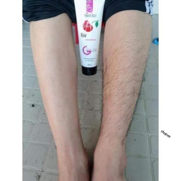 Kem Tẩy Lông Mwhite D.O.Pro | BigBuy360 - bigbuy360.vn